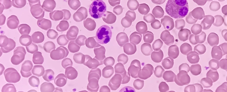 DataForce reviewed and annotated thousands of microscopic images of blood smear samples through the use of general artificial intelligence.